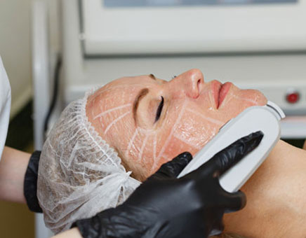 How Does Ultherapy Treatment Work