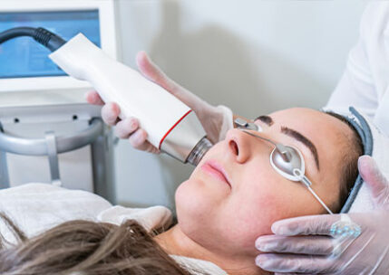 Rf Microneedling