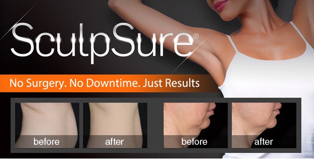 Sculpsure