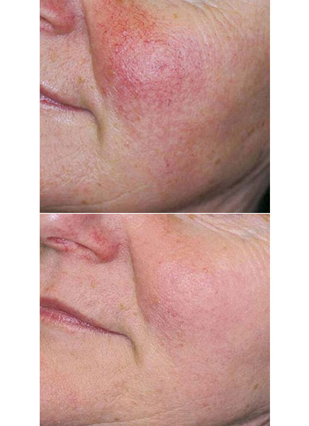A Complete Treatment Solution