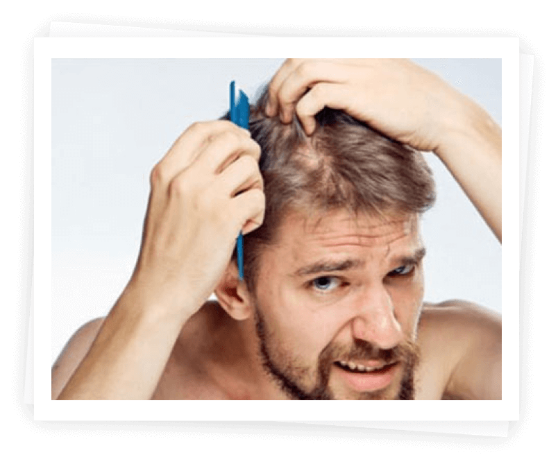 Hair Loss Treatment Hair Loss Treatment