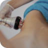 RF Body Tightening