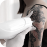 Tattoo Removal