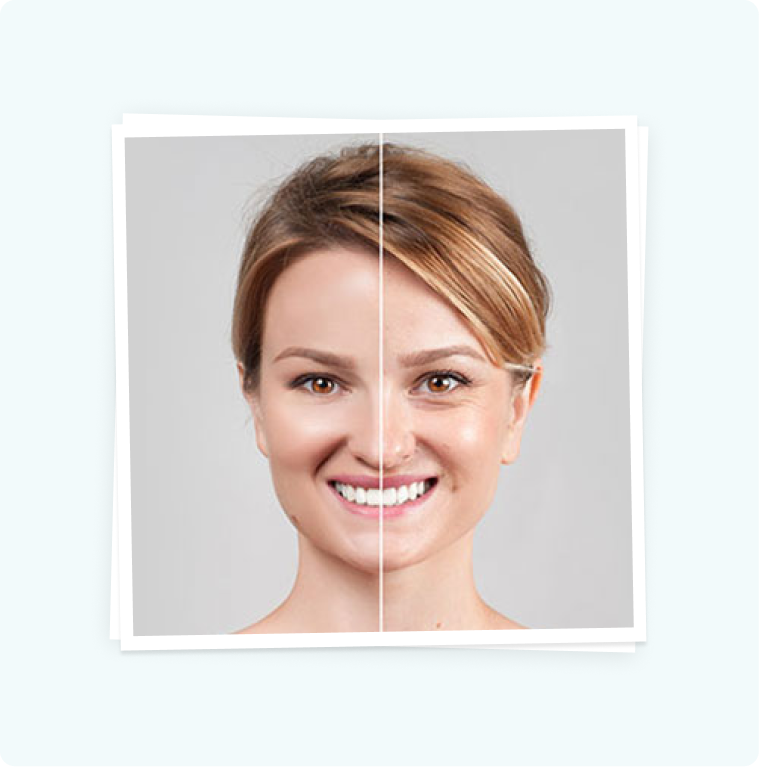 Skin Revitalization Skin Revitalization