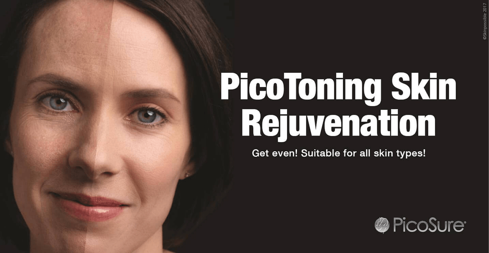 picotoning picotoning