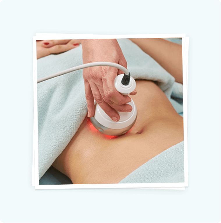 RF Skin Tightening Treatment RF Skin Tightening Treatment