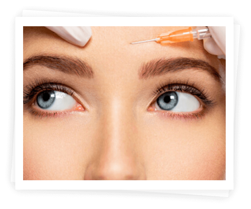 Dermal Fillers Dermal Fillers