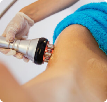 RF Body Tightening RF Body Tightening